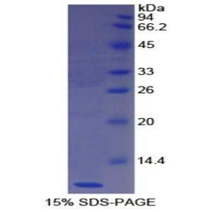 摄食抑制因子1(NES1)重组蛋白,Recombinant Nesfatin 1 (NES1)