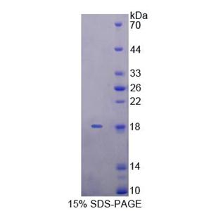 杀伤细胞凝集素样受体亚家族K成员1(KLRK1)重组蛋白,Recombinant Killer Cell Lectin Like Receptor Subfamily K, Member 1 (KLRK1)