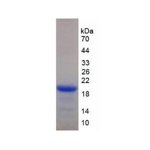 杀伤细胞凝集素样受体亚家族D成员1(KLRD1)重组蛋白
