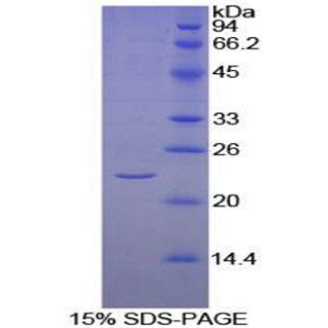 杀伤细胞凝集素样受体亚家族C成员2(KLRC2)重组蛋白