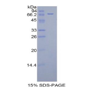 杀伤细胞免疫球蛋白样受体3DL3(KIR3DL3)重组蛋白
