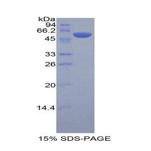 杀伤细胞免疫球蛋白样受体3DL2(KIR3DL2)重组蛋白