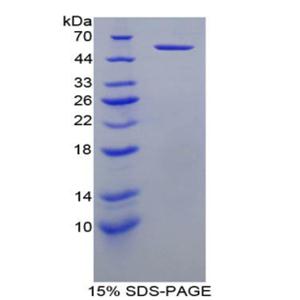 杀伤细胞免疫球蛋白样受体3DL1(KIR3DL1)重组蛋白,Recombinant Killer Cell Immunoglobulin Like Receptor 3DL1 (KIR3DL1)