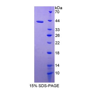 杀伤细胞免疫球蛋白样受体2DL5(KIR2DL5)重组蛋白