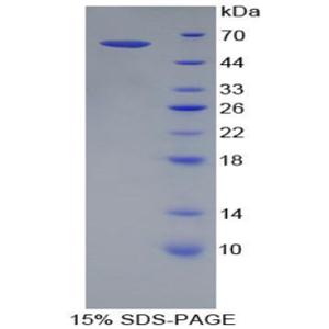 杀伤细胞免疫球蛋白样受体2DL3(KIR2DL3)重组蛋白