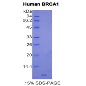 乳腺癌易感蛋白1(BRCA1)重组蛋白