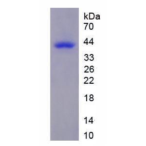 乳酸脱氢酶A(LDHA)重组蛋白