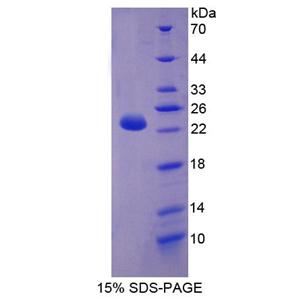 肉毒碱棕榈酰基转移酶1B(CPT1B)重组蛋白