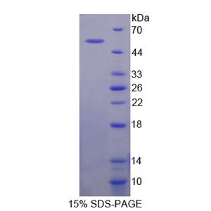 肉毒碱乙酰转移酶(CRAT)重组蛋白,Recombinant Carnitine Acetyltransferase (CRAT)