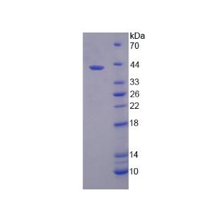 溶质载体家族39成员6(SLC39A6)重组蛋白,Recombinant Solute Carrier Family 39, Member 6 (SLC39A6)