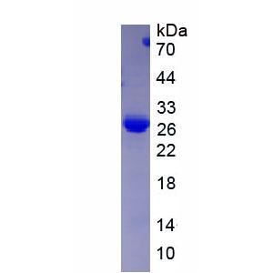 溶质载体家族30成员8(SLC30A8)重组蛋白
