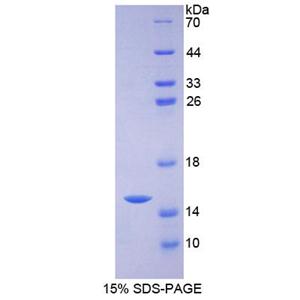 溶质载体家族30成员4(SLC30A4)重组蛋白,Recombinant Solute Carrier Family 30 Member 4 (SLC30A4)