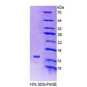 溶质载体家族30成员10(SLC30A10)重组蛋白,Recombinant Solute Carrier Family 30, Member 10 (SLC30A10)