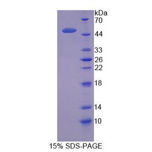 溶质载体家族1成员5(SLC1A5)重组蛋白,Recombinant Solute Carrier Family 1, Member 5 (SLC1A5)