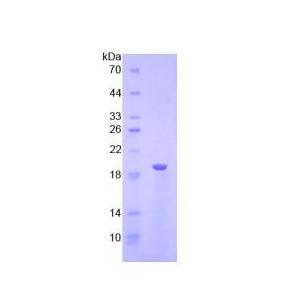 溶血卵磷脂酰基转移酶3(LPCAT3)重组蛋白