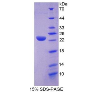 溶酶体酸脂肪酶A(LIPA)重组蛋白,Recombinant Lipase A, Lysosomal Acid (LIPA)