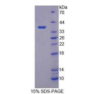 妊娠特异性β1-糖蛋白2(PSG2)重组蛋白