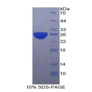 妊娠特异性β1-糖蛋白(PSG1)重组蛋白
