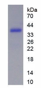 熱休克轉(zhuǎn)錄因子1(HSF1)重組蛋白,Recombinant Heat Shock Transcription Factor 1 (HSF1)