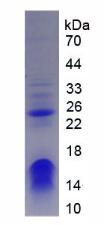 染色质域解旋酶DNA结合蛋白3(CHD3)重组蛋白,Recombinant Structural Maintenance Of Chromosomes Protein 3 (SMC3)