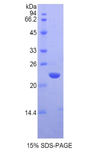 染色框同源物3(CBX3)重组蛋白,Recombinant Chromobox Homolog 3 (CBX3)