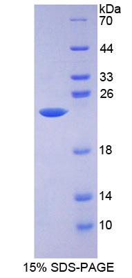 醛脱氢酶9家族成员A1(ALDH9A1)重组蛋白,Recombinant Aldehyde Dehydrogenase 9 Family, Member A1 (ALDH9A1)