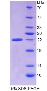 醛脫氫酶1家族成員A3(ALDH1A3)重組蛋白,Recombinant Aldehyde Dehydrogenase 1 Family, Member A3 (ALDH1A3)