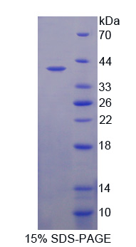 醛糖还原酶相似蛋白1(ARL1)重组蛋白,Recombinant Aldose Reductase Like Protein 1 (ARL1)