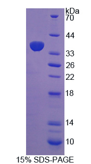 全细胞色素C合酶(HCCS)重组蛋白,Recombinant Holocytochrome C Synthase (HCCS)