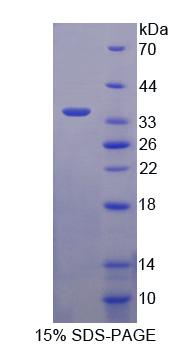 去唾液酸糖蛋白受体2(ASGR2)重组蛋白,Recombinant Asialoglycoprotein Receptor 2 (ASGR2)