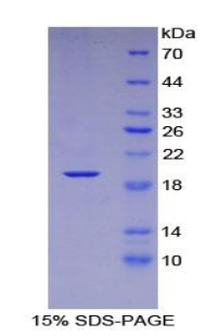 趋化因子C-X-C-基元配体16(CXCL16)重组蛋白,Recombinant Chemokine C-X-C-Motif Ligand 16 (CXCL16)