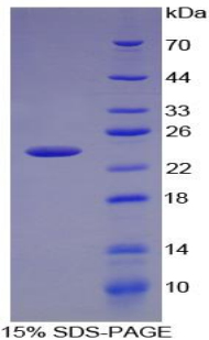 趋化因子C-X-C-基元配体15(CXCL15)重组蛋白,Recombinant Chemokine C-X-C-Motif Ligand 15 (CXCL15)