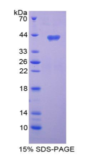 趋化因子C-C-基元配体3样蛋白1(CCL3L1)重组蛋白,Recombinant Chemokine C-C-Motif Ligand 3 Like Protein 1 (CCL3L1)