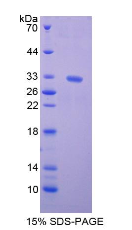 驱动蛋白家族成员5B(KIF5B)重组蛋白,Recombinant Kinesin Family, Member 5B (KIF5B)