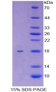 驱动蛋白家族成员5A(KIF5A)重组蛋白,Recombinant Kinesin Family, Member 5A (KIF5A)