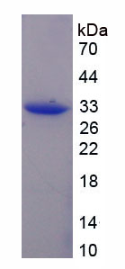 驱动蛋白家族成员1A(KIF1A)重组蛋白,Recombinant Kinesin Family, Member 1A (KIF1A)