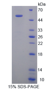 驱动蛋白家族成员18A(KIF18A)重组蛋白,Recombinant Kinesin Family, Member 18A (KIF18A)