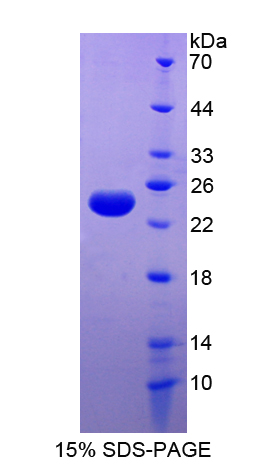 轻肽铁蛋白(FTL)重组蛋白,Recombinant Ferritin, Light Polypeptide (FTL)