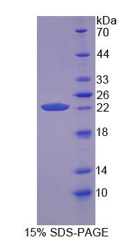 亲环素B(CYPB)重组蛋白,Recombinant Cyclophilin B (CYPB)