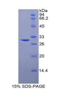 鞘氨醇激酶1(SPHK1)重组蛋白,Recombinant Sphingosine Kinase 1 (SPHK1)