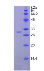 鞘氨醇1磷酸酯裂解酶1(SGPL1)重組蛋白,Recombinant Sphingosine 1 Phosphate Lyase 1 (SGPL1)