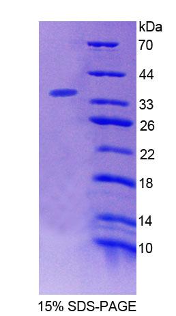 桥连整合因子2(BIN2)重组蛋白,Recombinant Bridging Integrator 2 (BIN2)