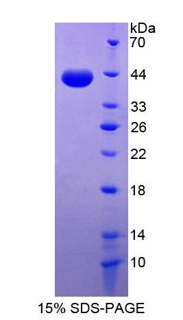 桥粒芯胶粘蛋白2(DSC2)重组蛋白,Recombinant Desmocollin 2 (DSC2)