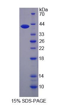 橋粒聯(lián)結(jié)蛋白(AHNAK)重組蛋白,Recombinant Desmoyokin (AHNAK)