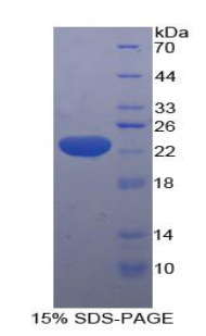 羟甲基戊二酰辅酶A合酶(HMGCS)重组蛋白,Recombinant Hydroxymethylglutaryl Coenzyme A Synthase (HMGCS)