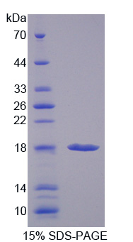 前折叠蛋白亚基1(PFDN1)重组蛋白,Recombinant Prefoldin Subunit 1 (PFDN1)