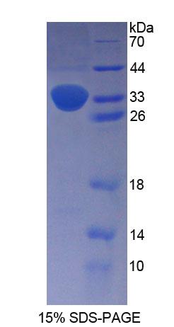 前脑啡肽(PENK)重组蛋白,Recombinant Proenkephalin (PENK)