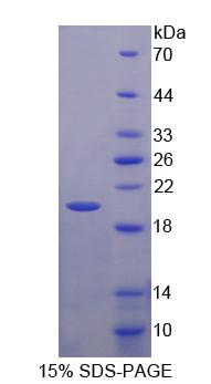 前列腺素E受体1(EP1)重组蛋白,Recombinant Prostaglandin E Receptor 1 (EP1)