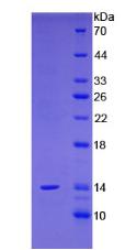 前列腺干细胞抗原(PSCA)重组蛋白,Recombinant Prostate Stem Cell Antigen (PSCA)