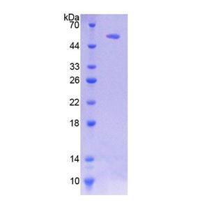熱休克轉錄因子2(HSF2)重組蛋白